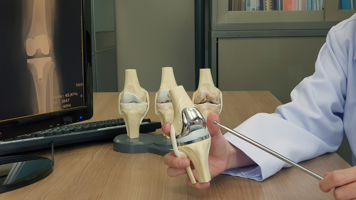 Total Knee Replacement Surgery Cost in Delhi
